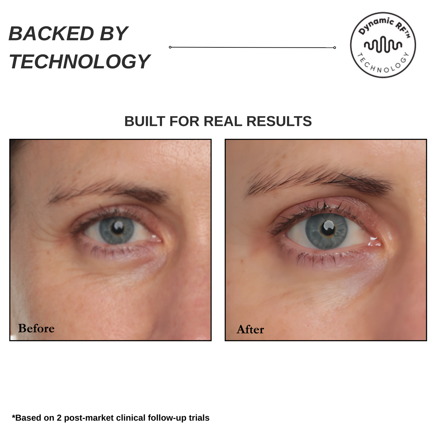 Sensilift At-Home Skin-Firming