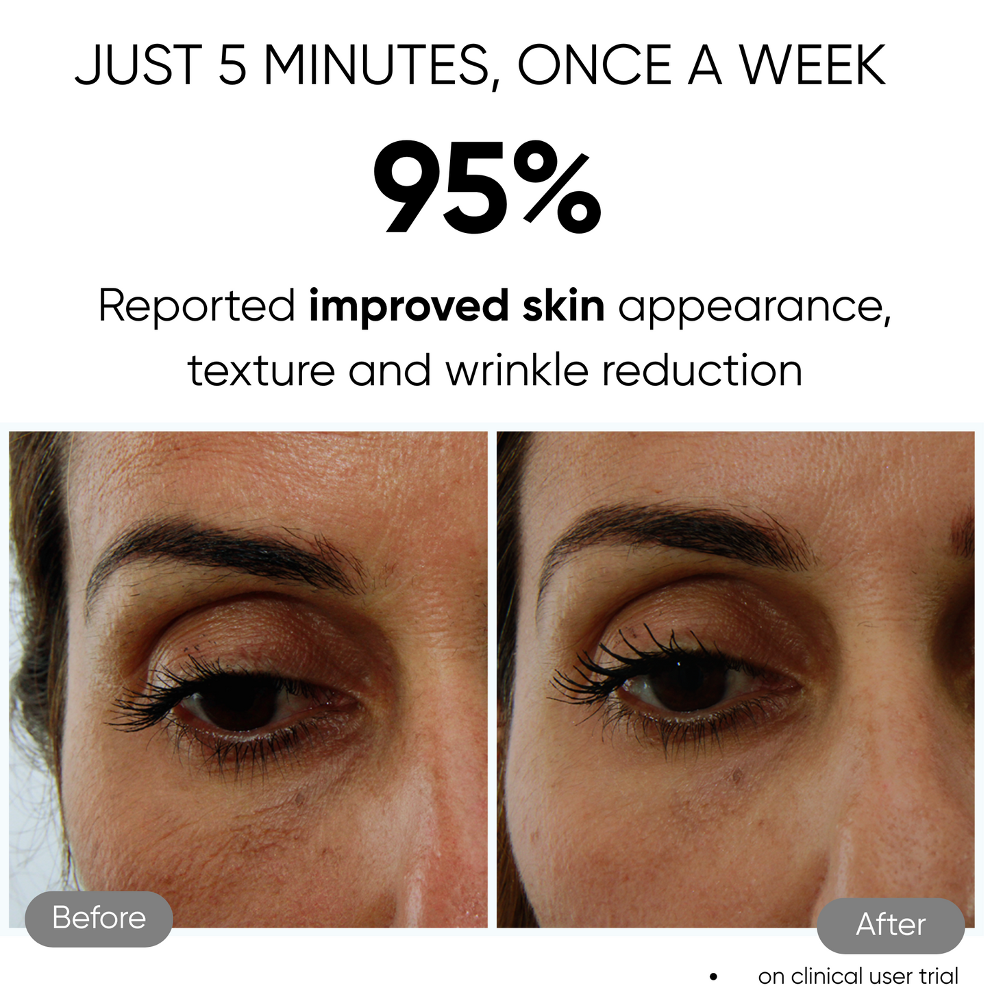 Sensilift Before & After