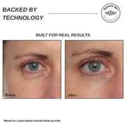 Sensilift At-Home Skin-Firming