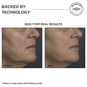 Sensilift At-Home Skin-Firming