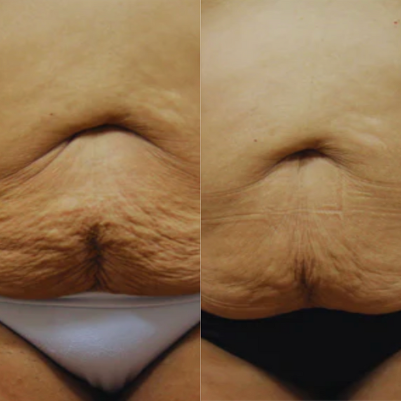 Before and after comparison