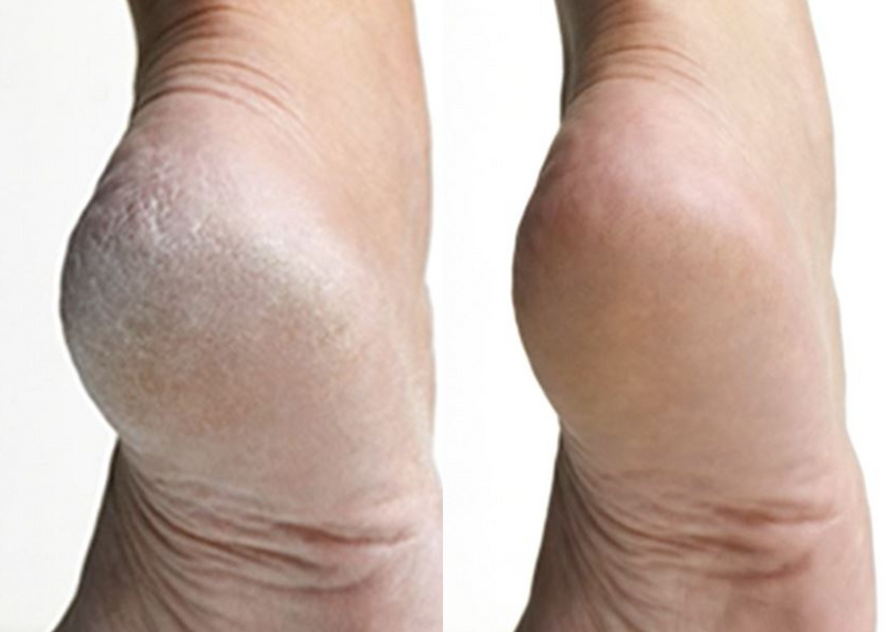 Before and after comparison