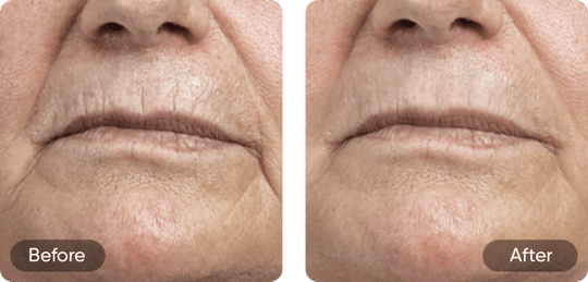 Before and after comparison