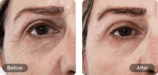 Before and after comparison