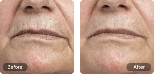 Before and after comparison