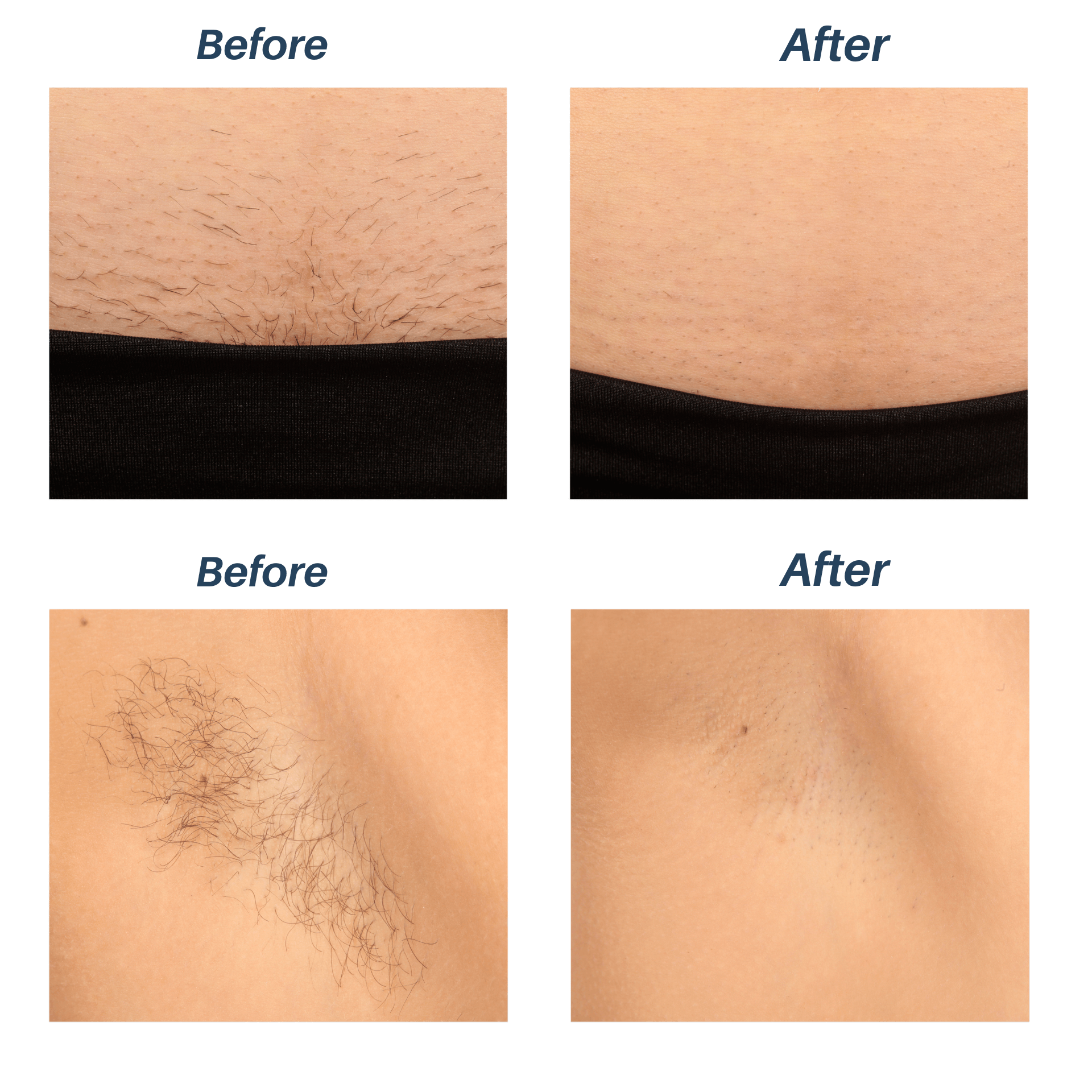Before and After